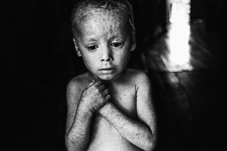 Scopri di più sull'articolo Le foto di come il glifosato sta uccidendo gli argentini