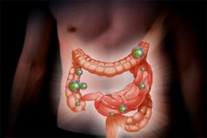 Scopri di più sull'articolo Infiammazioni intestinali? Ci pensano le mele